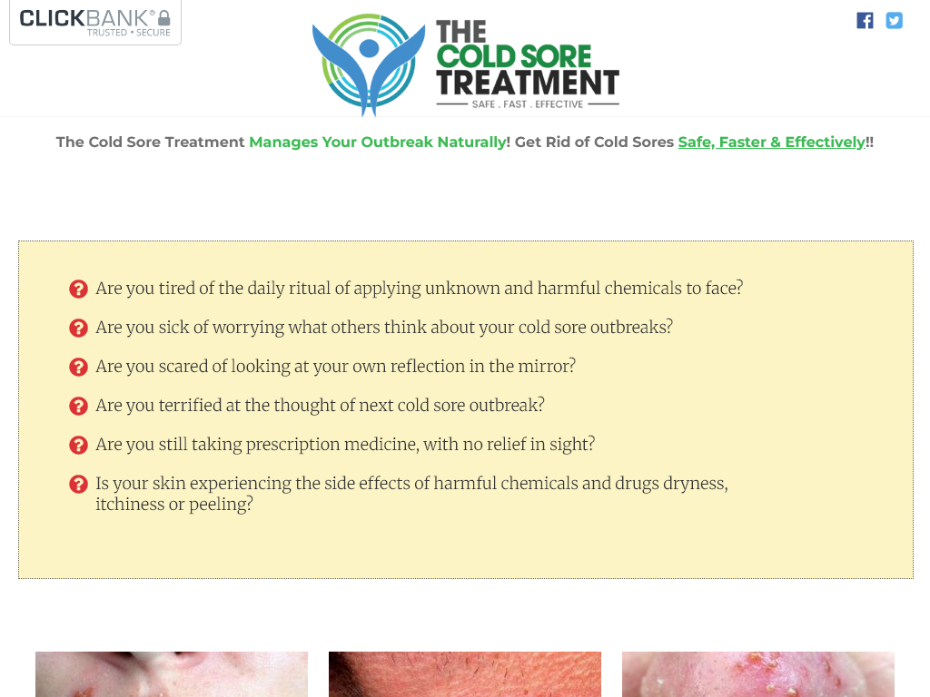 COLD SORE TREATMENT REVIEW : THE CHANGE VISIBLE AFTER 10 DAYS