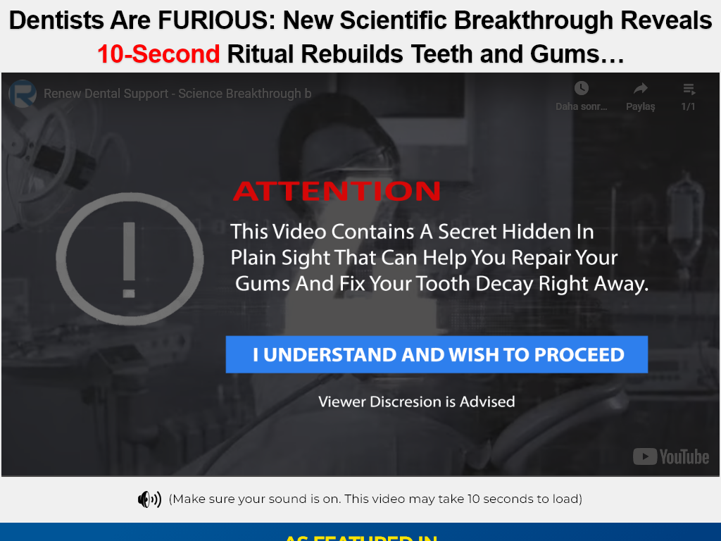 RENEW DENTAL SUPPORT REVIEW – MY 14 DAY EXPERIMENT WORKED