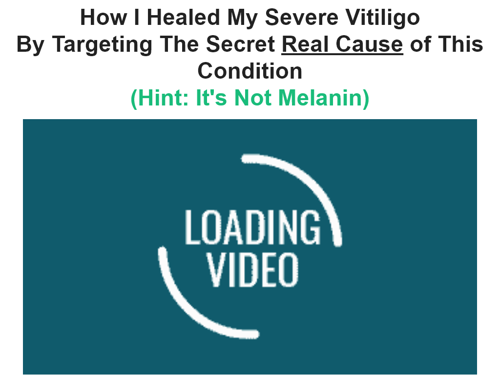VITILIGO MIRACLE REVIEW | THE RESULTS WERE UNEXPECTED